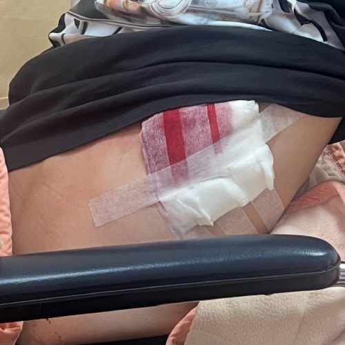 피해자 한국인 부상 사진.<피해자 신모 씨의 스레드 캡처, 연합뉴스>